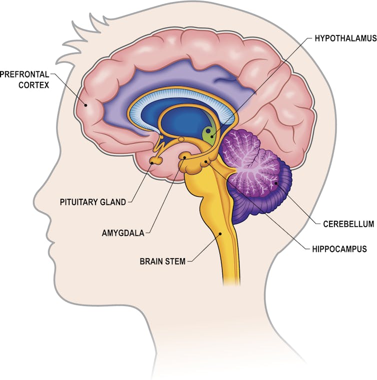 Full color cross-sectional side view of a child's brain with labels.