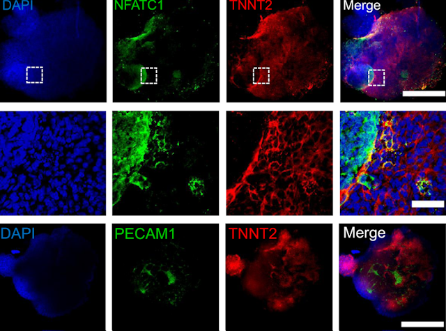 Grid of nine microscopy images of heart cells with different proteins colored blue, green or red, with the last column a merge of all three proteins