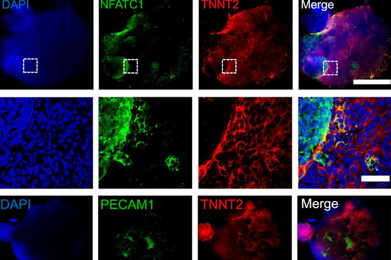 Grid of nine microscopy images of heart cells with different proteins colored blue, green or red, with the last column a merge of all three proteins