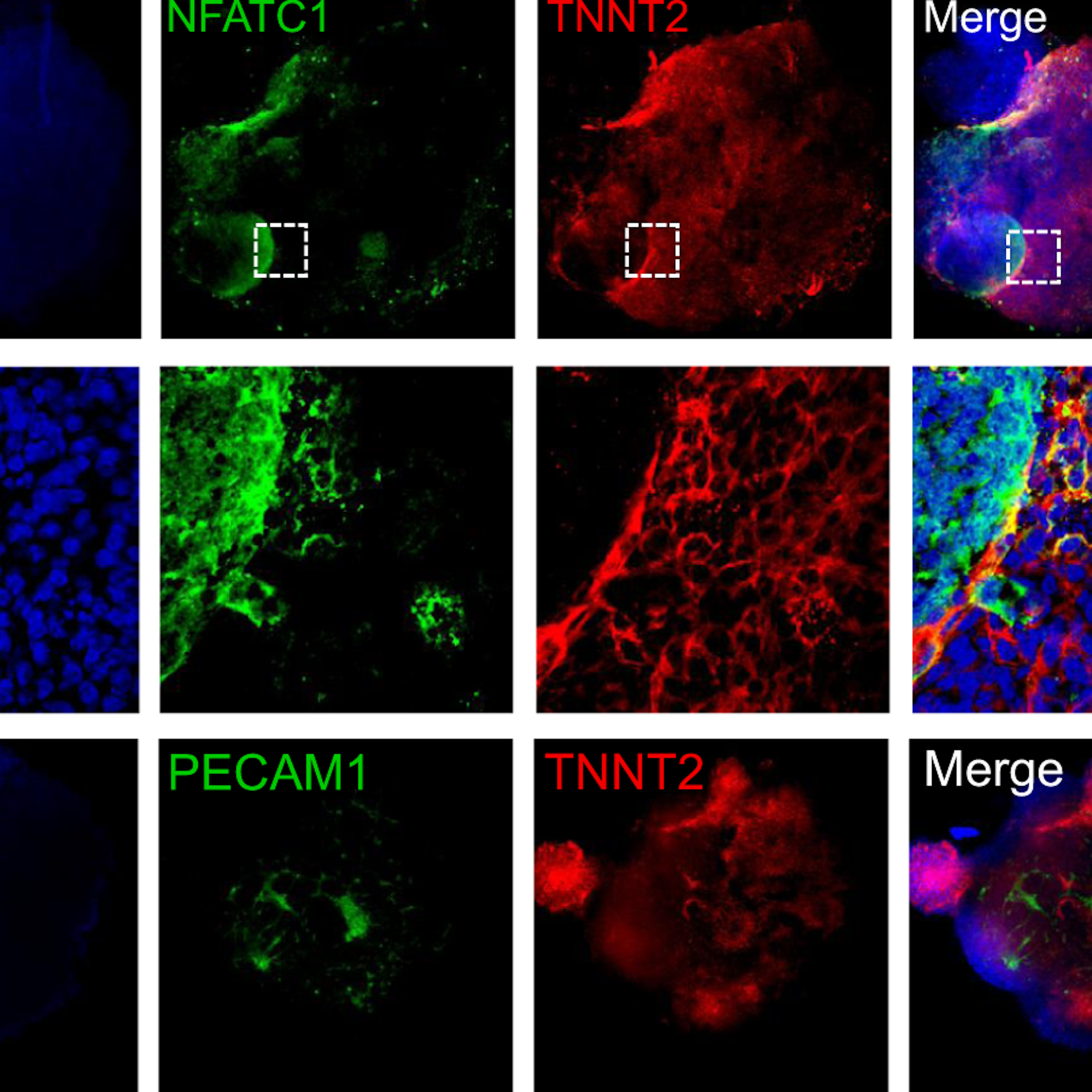 Grid of nine microscopy images of heart cells with different proteins colored blue, green or red, with the last column a merge of all three proteins