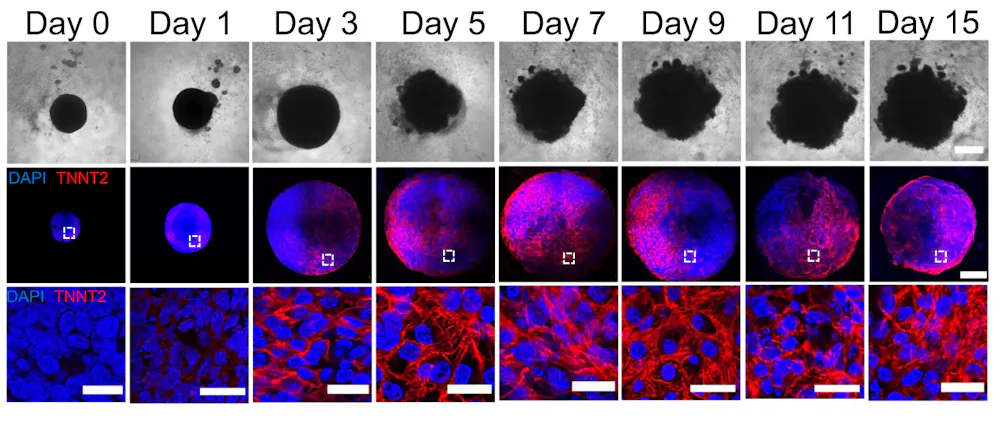 Engineering mini human hearts to study pregnancy complications and ...