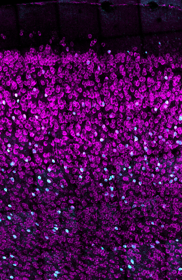 Image of hormone receptors in the prefrontal cortex of the brain illuminated in different colors.