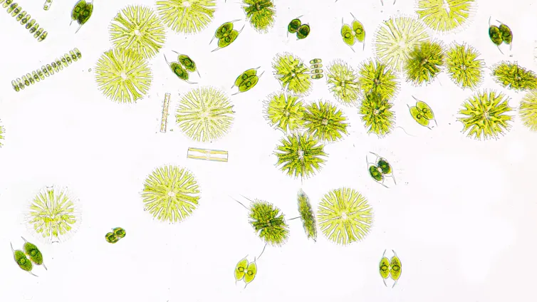lime green-coloured microorganisms on a white background