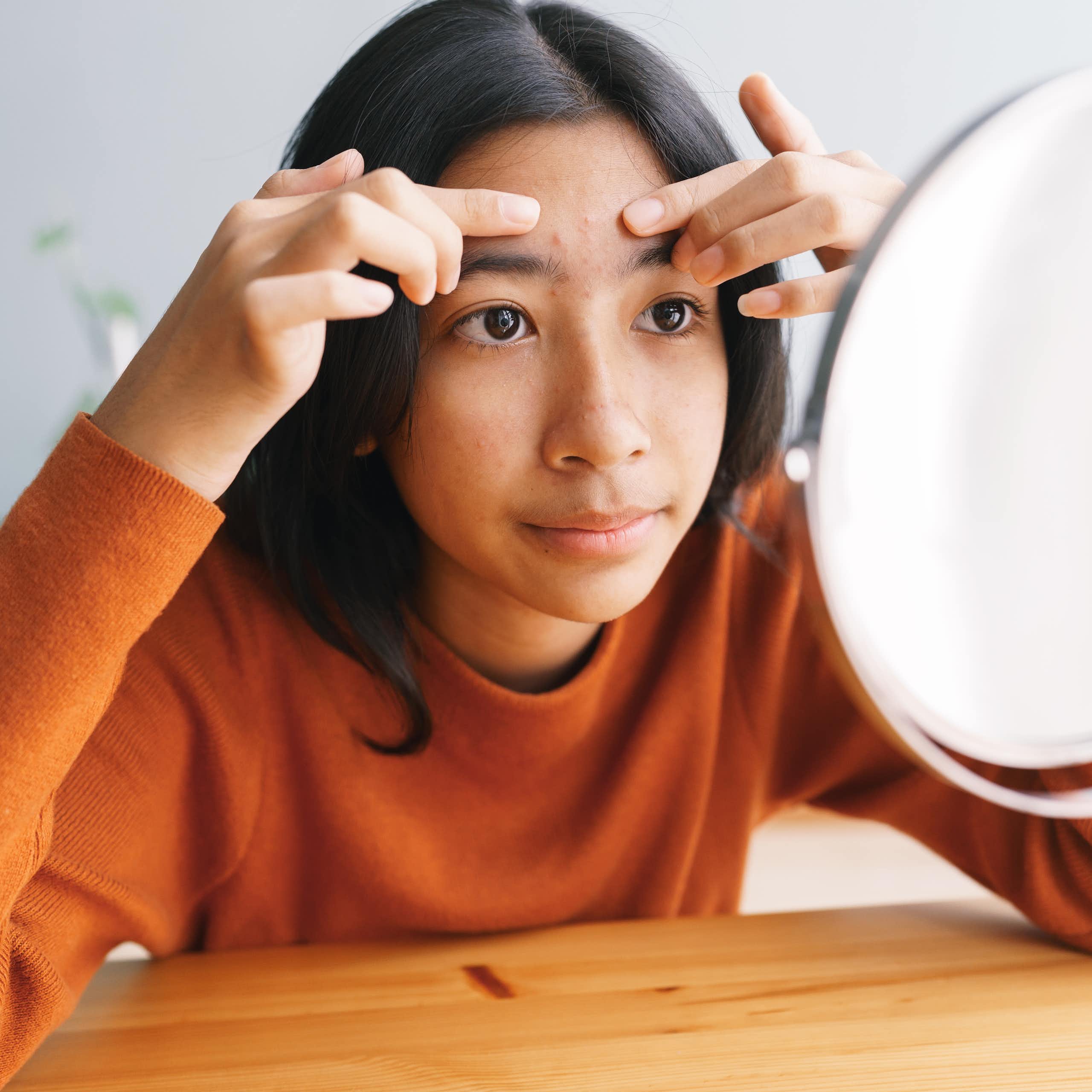 A young woman examines acne on her forehead in a mirror.