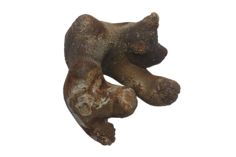 Staghorn-shaped kidney stone or renal stone