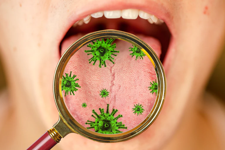 A person holds their mouth open, while a magnifying glass illustrates the bacteria found there.