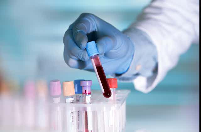A lab technician wearing a blue surgical glove holds a vial of blood.