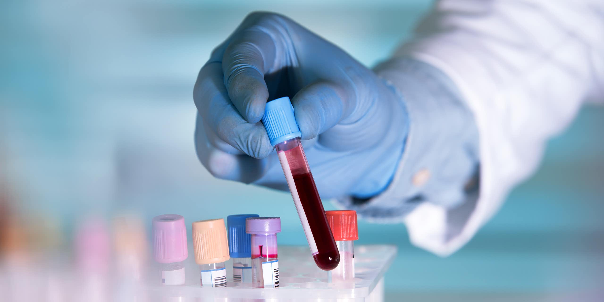 A lab technician wearing a blue surgical glove holds a vial of blood.
