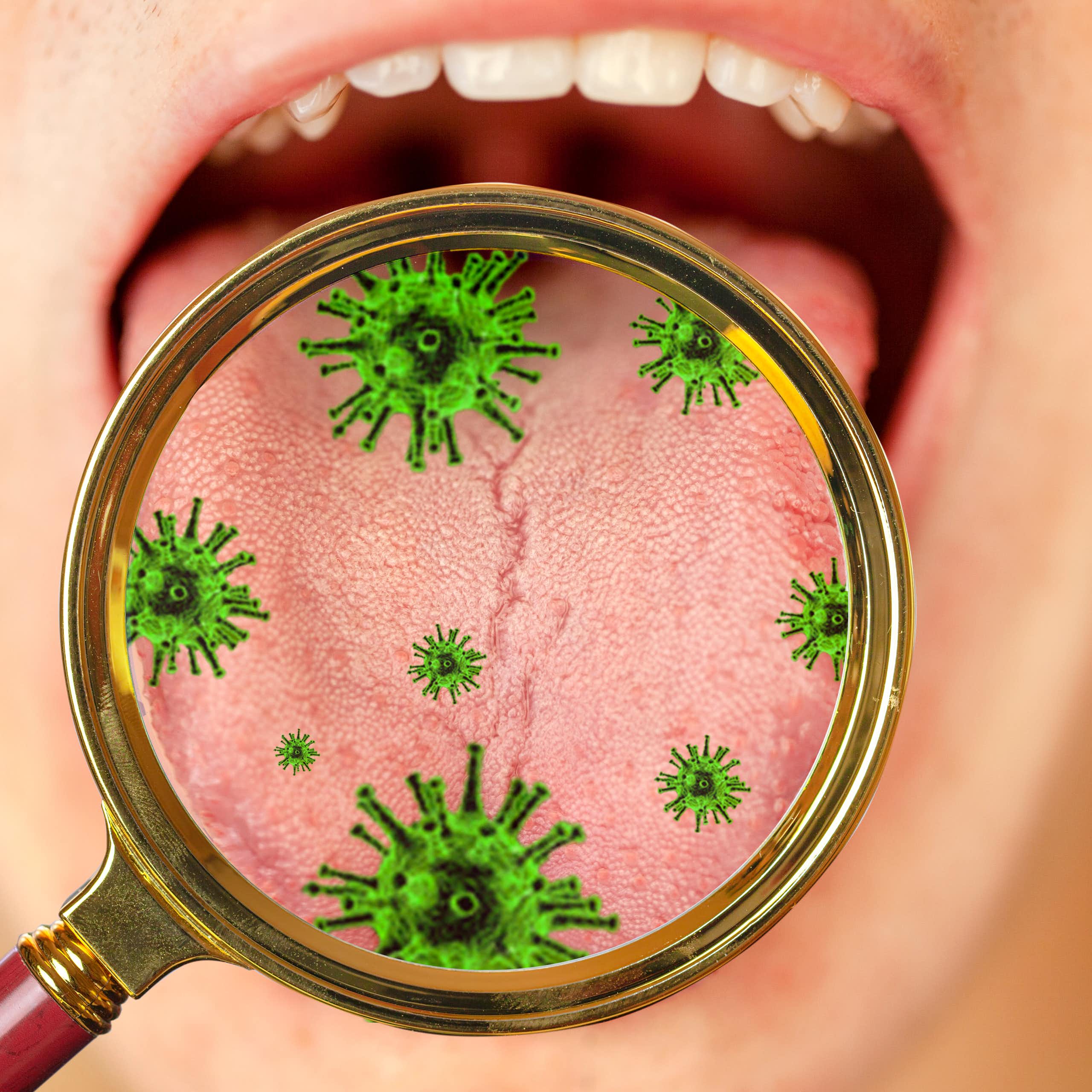 Uma pessoa mantém a boca aberta, enquanto uma lente de aumento ilustra as bactérias encontradas nela.