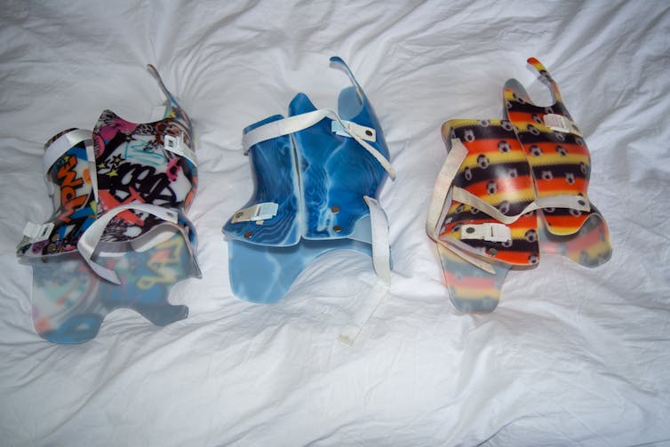 Braces used to treat scoliosis.