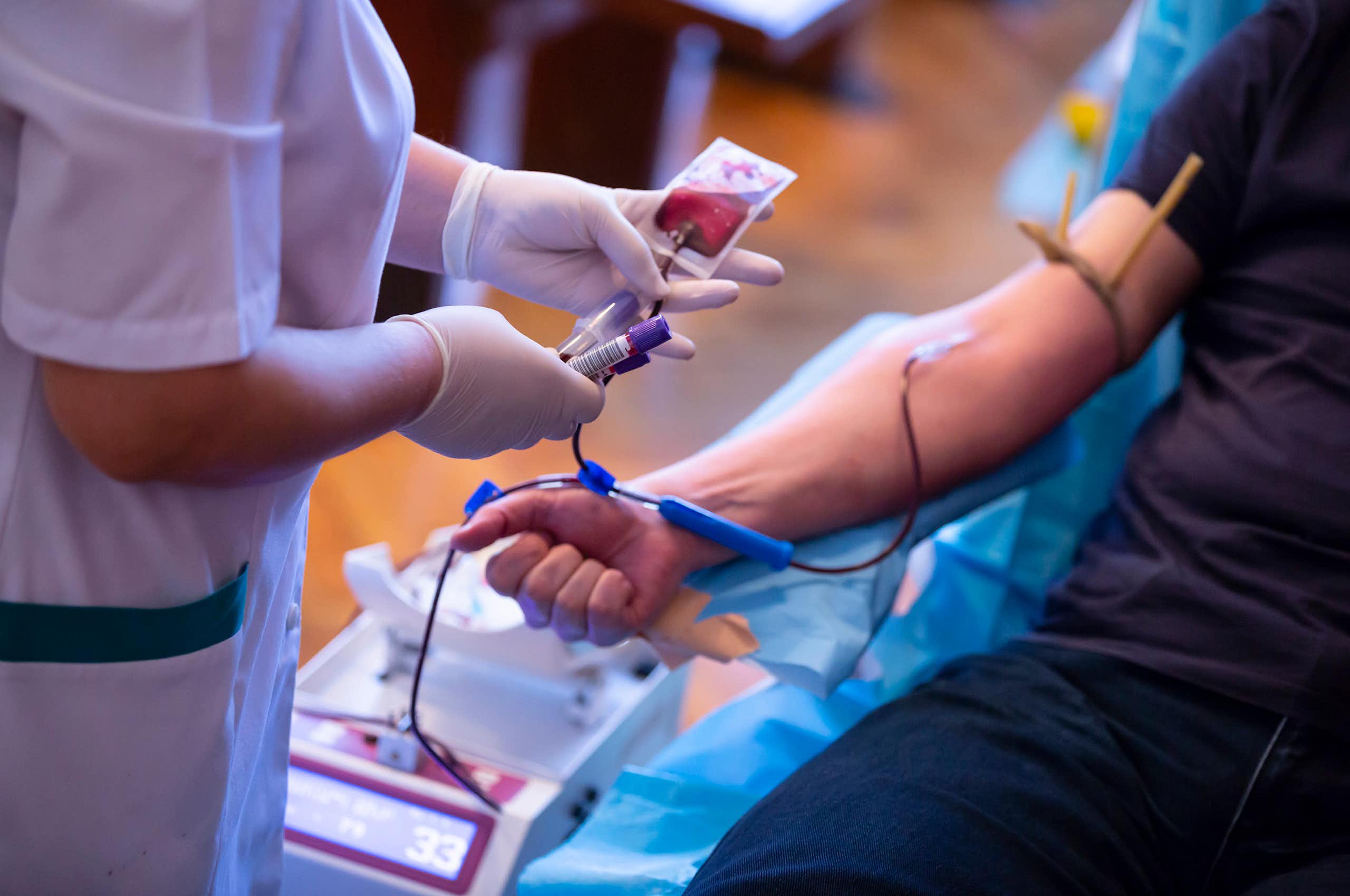 Hemocromatosis: una enfermedad subestimada y sus desafíos en el sistema de donación de sangre
