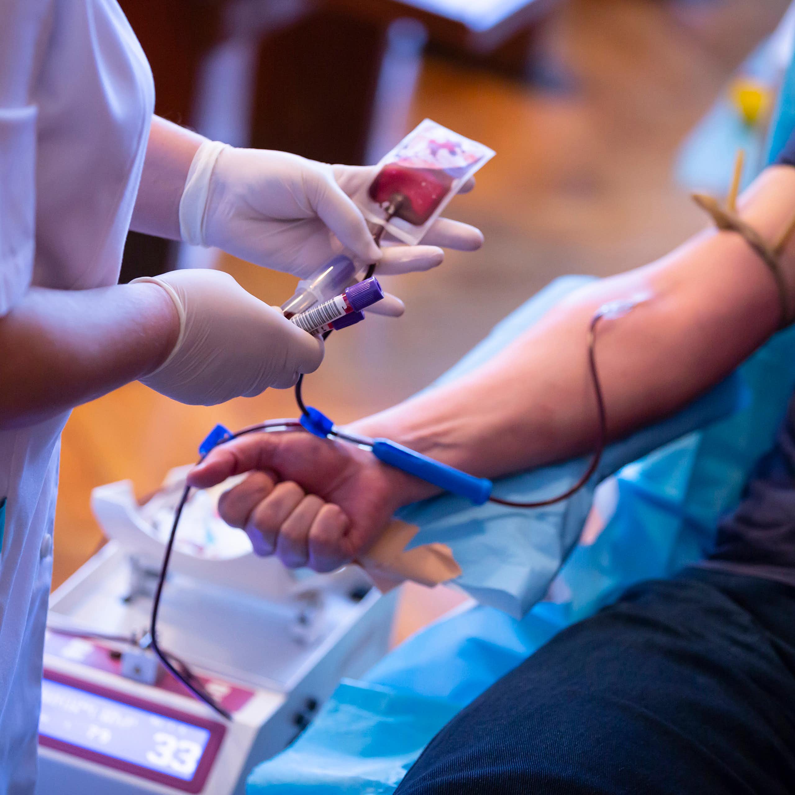 Hemocromatosis: una enfermedad subestimada y sus desafíos en el sistema de donación de sangre