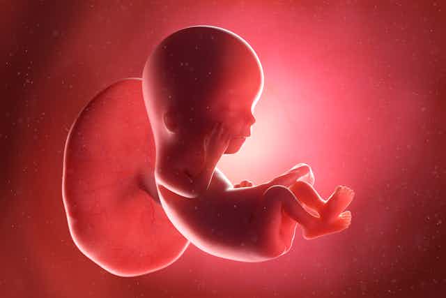 Image of a foetus