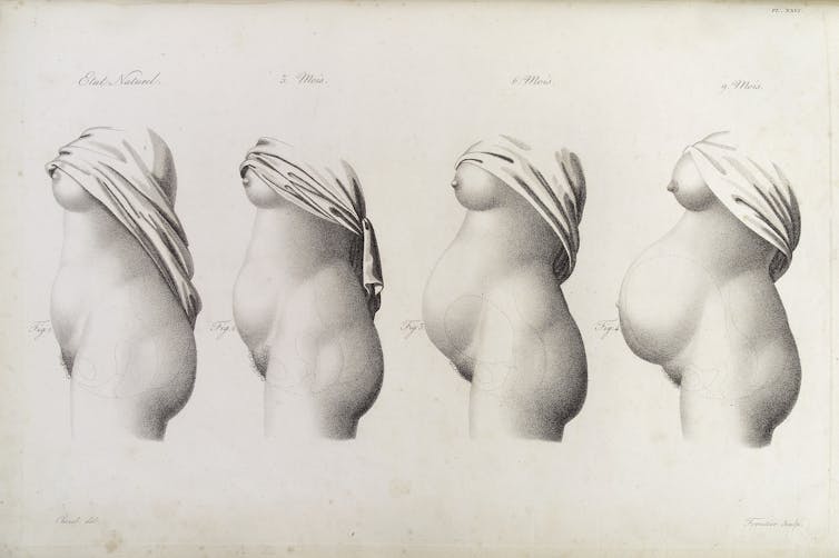 A historical drawing of four female bodies next to each other showing the growth of the womb in a pregnant woman