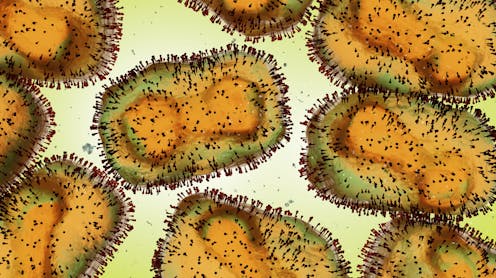 Mpox is on the rise in Australia. Here’s what to know about the virus – and who should get vaccinated
