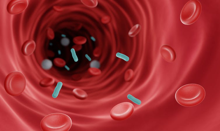 A digital drawing of bacteria entering the bloodstream.