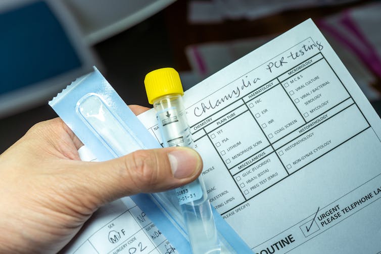 Hand holding swab, vial tube and medical form with