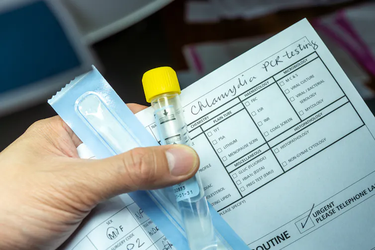 Hand holding swab, vial tube and medical form with