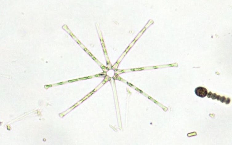 A close up of a diatom. It looks like eight arms going out from a center.