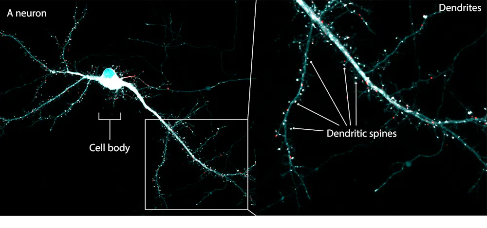 Memory Structure Physical Nanoscopic motor proteins in the brain build the physical structures of ...