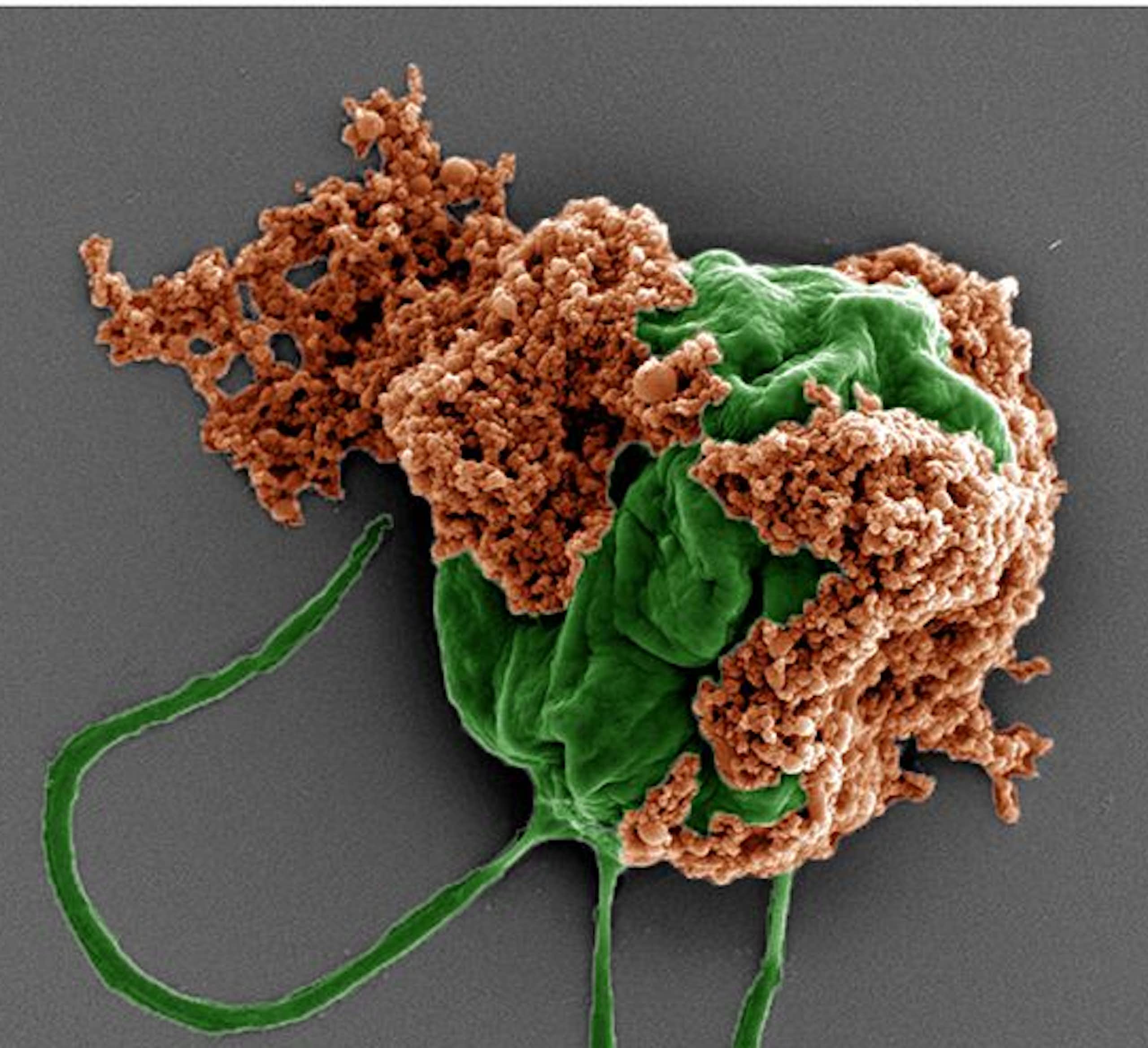 Microscopy image of green spherical organism with two hair-like extensions and clumps of rust-colored membranes on its surface