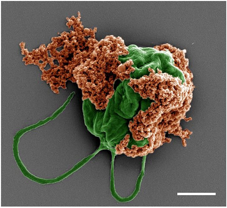 Microrobots made of algae carry chemo directly to lung tumors, improving cancer treatment