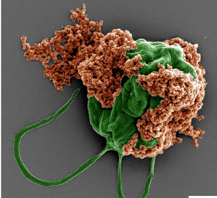 Microrobots made of algae carry chemo directly to lung tumors, improving cancer treatment