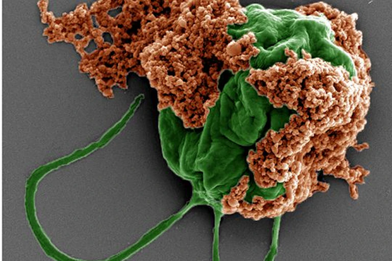 Microscopy image of green spherical organism with two hair-like extensions and clumps of rust-colored membranes on its surface