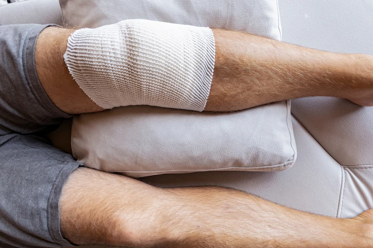 Man lying on sofa, legs stretched out, one knee bandaged after surgery