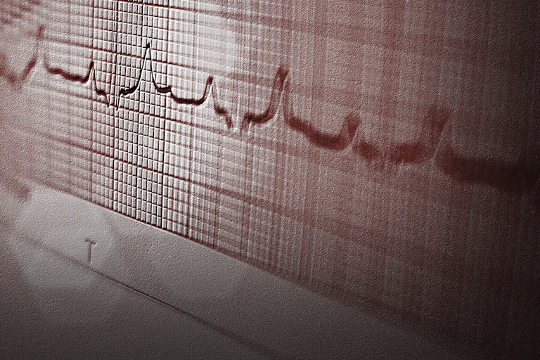 Abstract photo of a graph