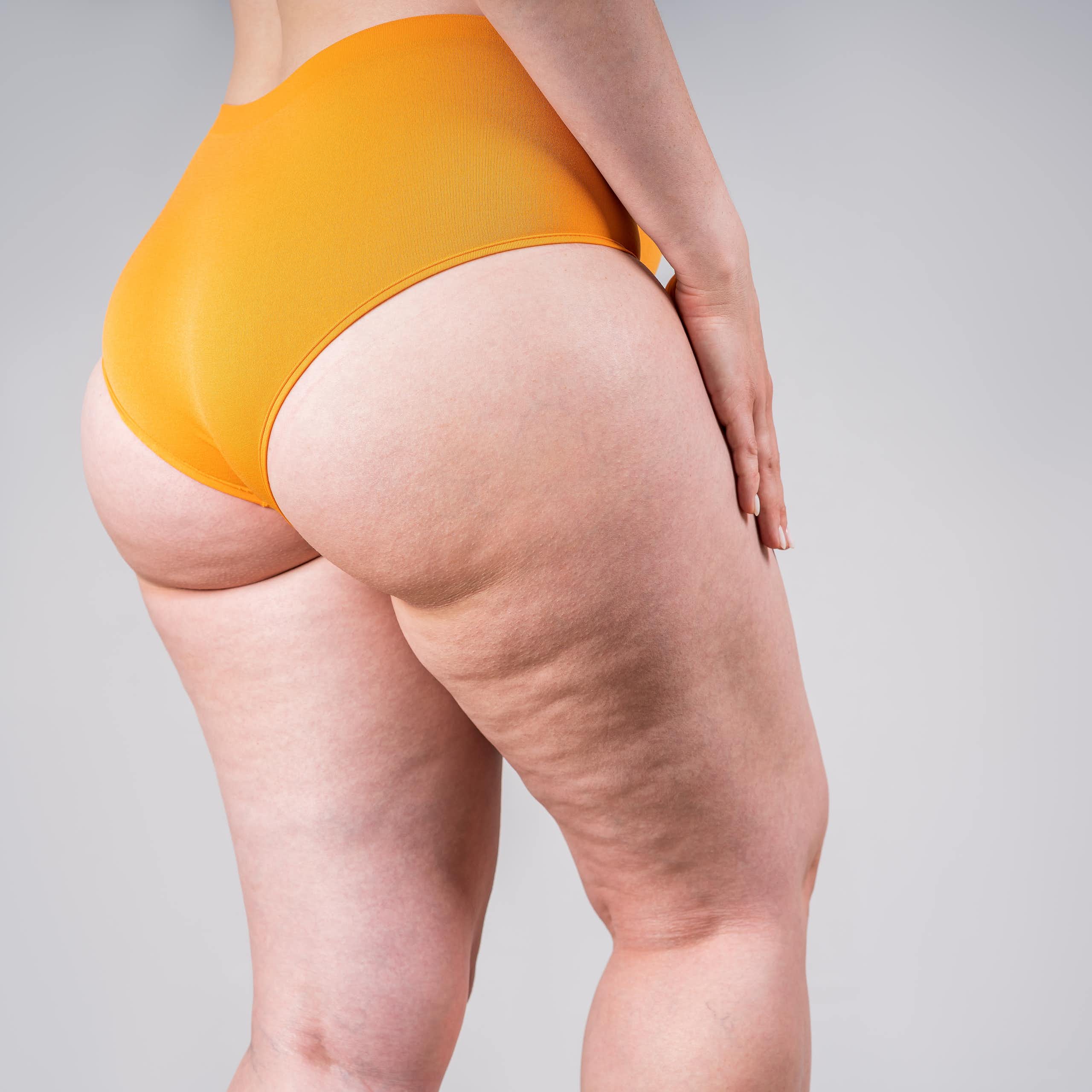 Anti-cellulite products are big business – but here’s what the science says