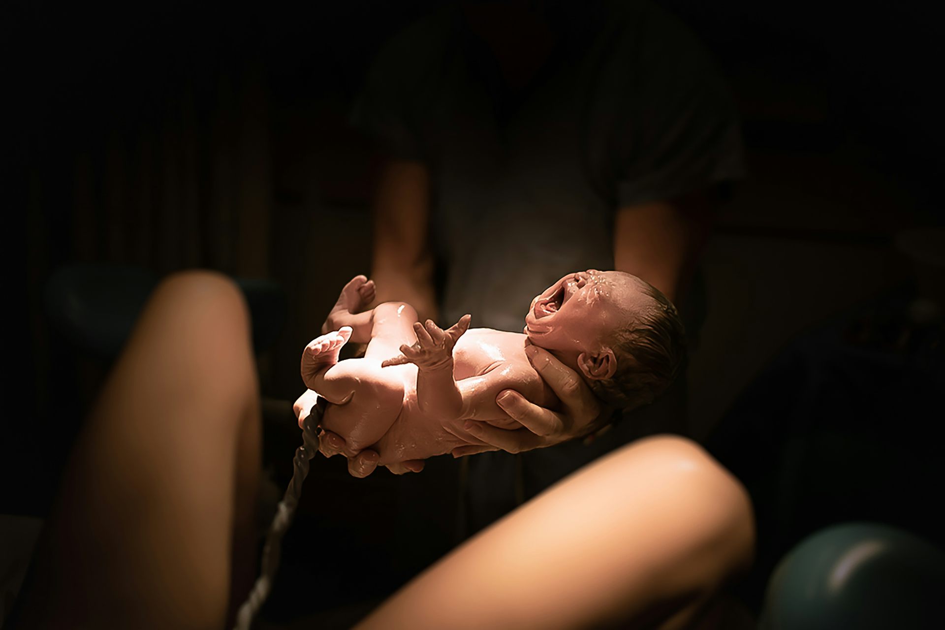 Baby being born in vaginal delivery.