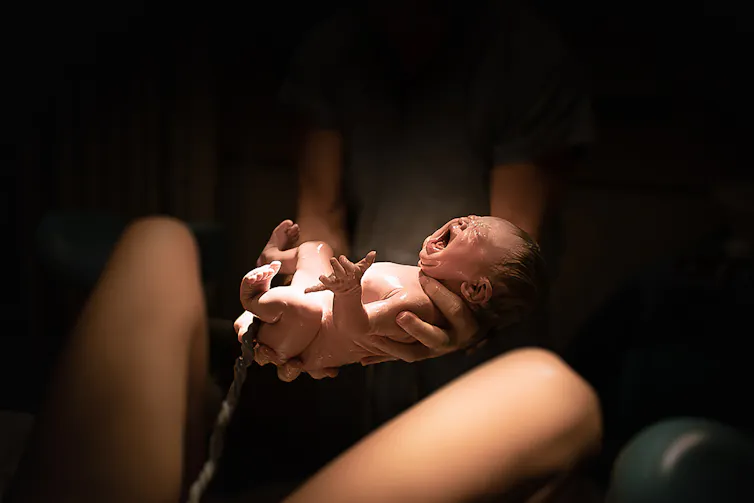 Baby being born in vaginal delivery.