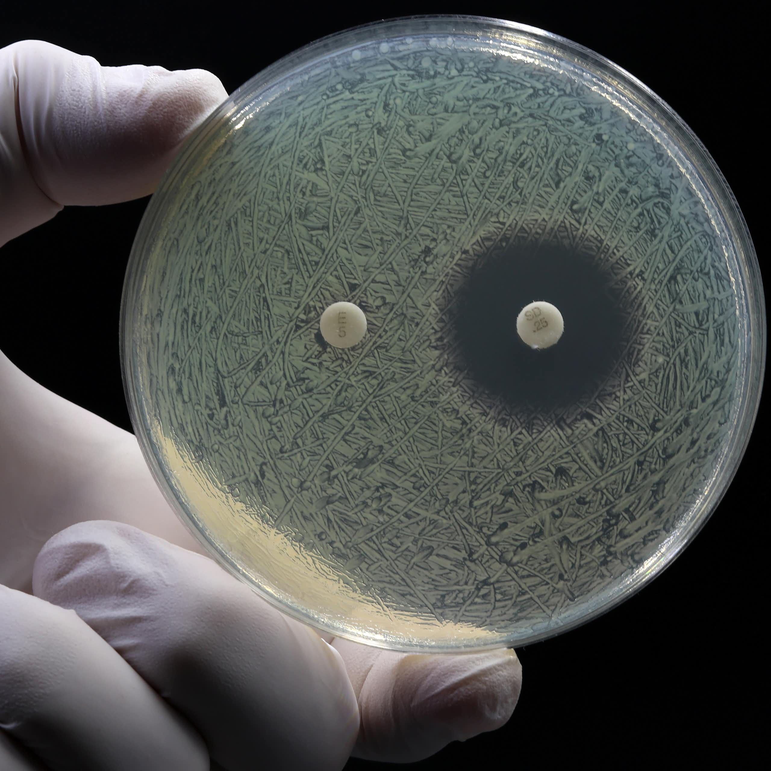 Nuevos antibióticos: tres buenas noticias en la guerra contra las superbacterias