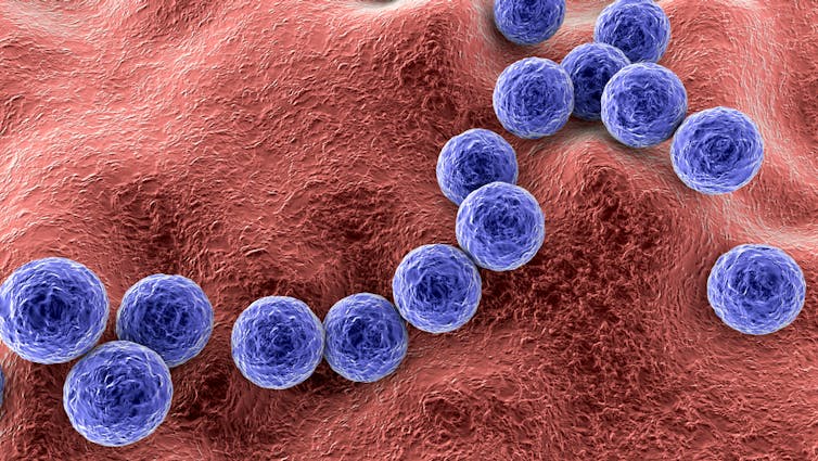 Streptococcus pyogenes