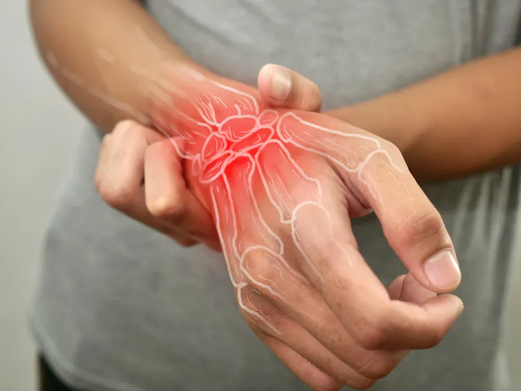 a person holding their wrist — muscles and bones are illustrated