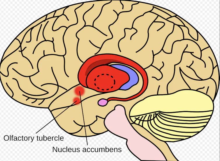 Image showing Striatum in red.