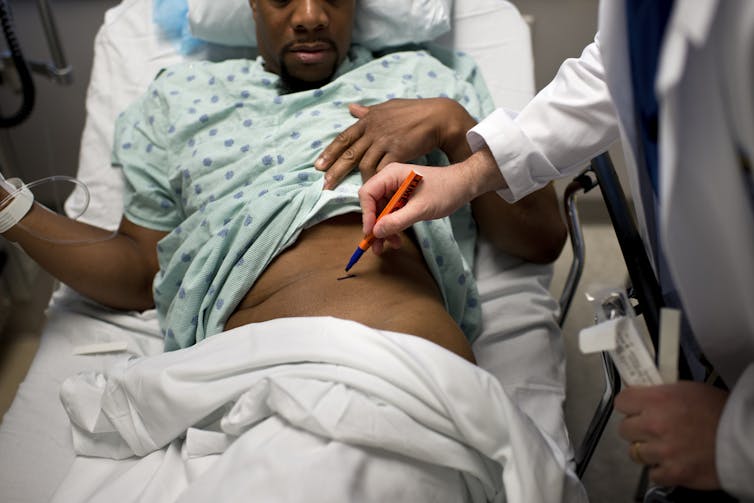 A black man lifts his gown as a doctor uses a marker to indicate which kidney to remove during surgery.
