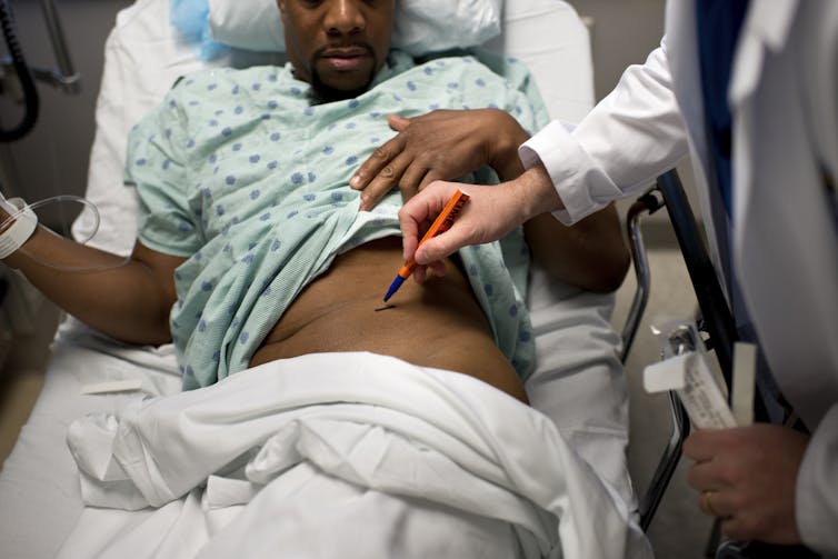 A black man raises his gown as a doctor uses a marker to show which kidney is to be removed during surgery.