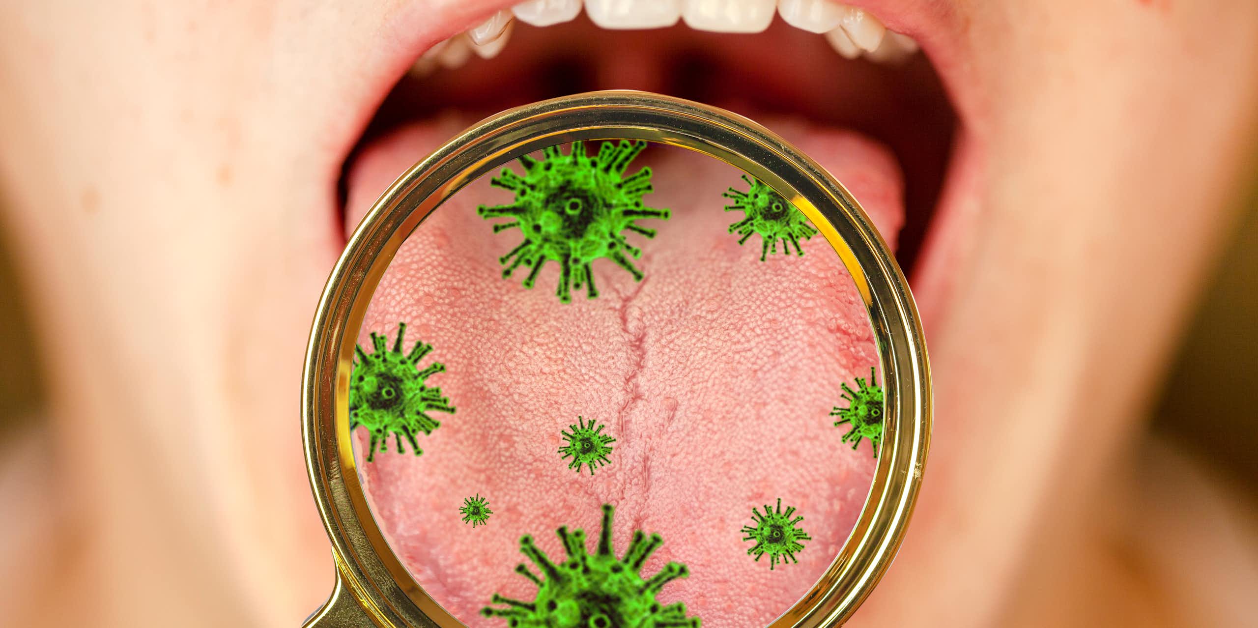 Une personne tient sa bouche ouverte, tandis qu'une illustration figure une loupe grossissant les bactéries qui s'y trouvent.