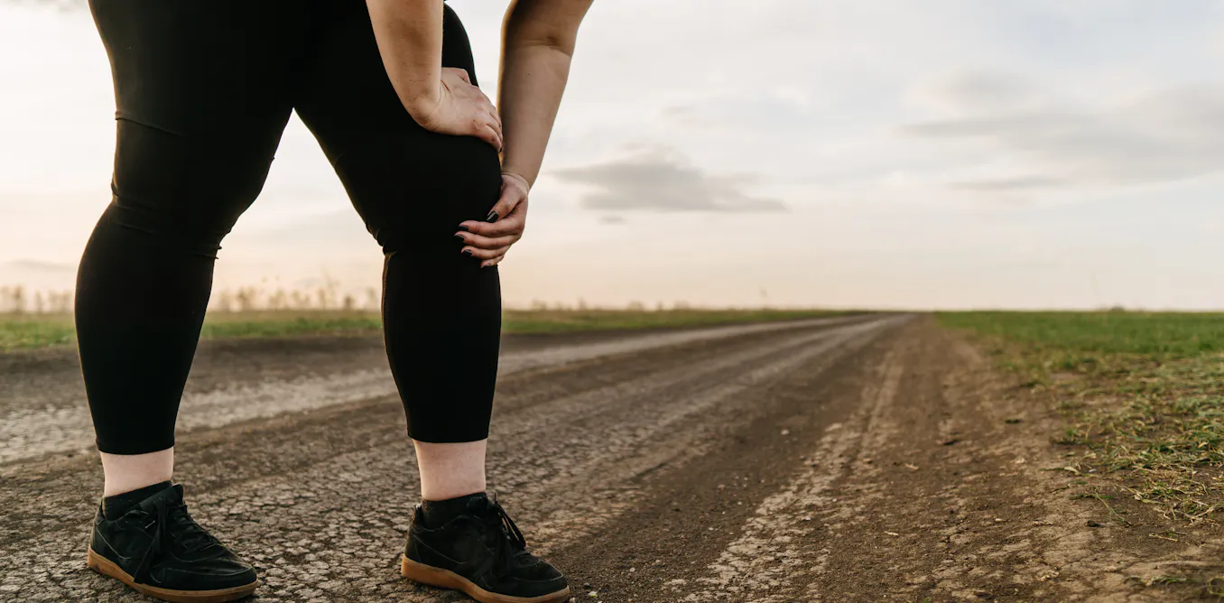 Qué sabemos del lipedema, una enfermedad con acumulación de grasa patológica que afecta sobre todo a las mujeres