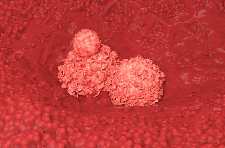 Breast cancer cell growing