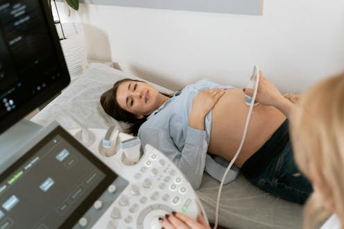 If you’re pregnant, how accurate is your ‘due date’?