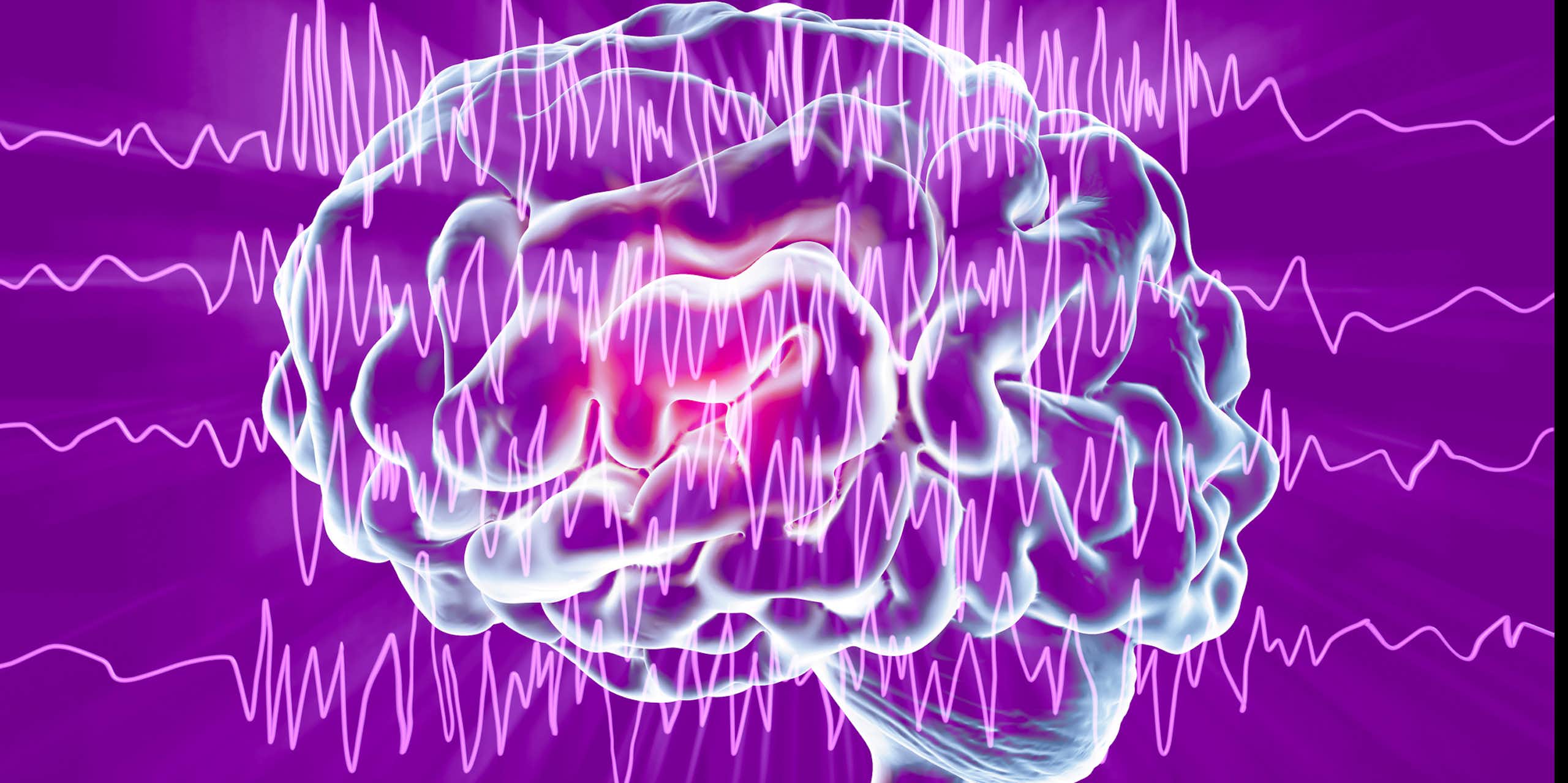 Illustration of brain with EEG epilepsy reading superimposed across it