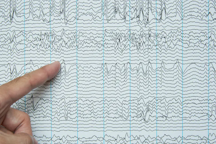 Dedo apontando para leitura de EEG