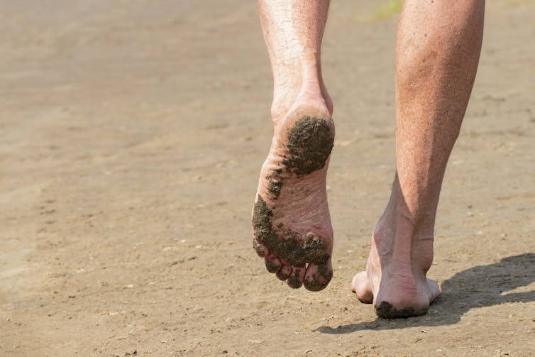 A picture of bare feet on sand.