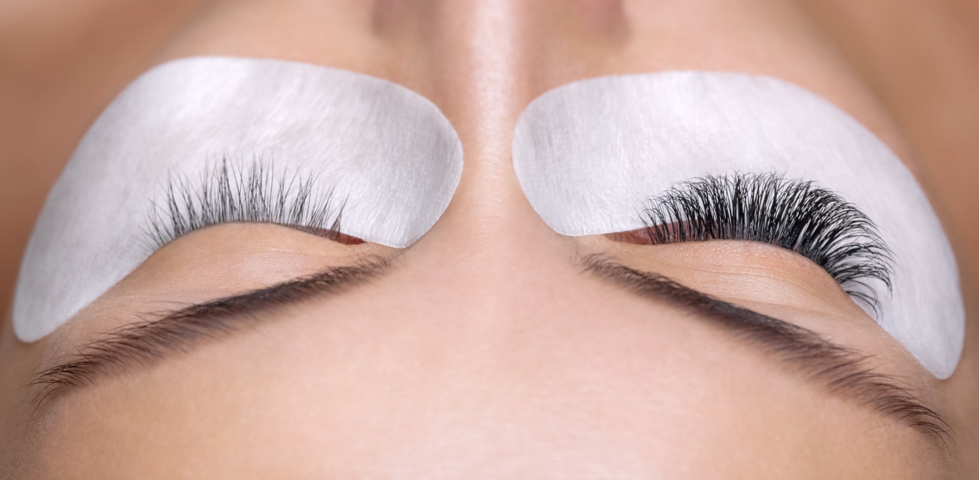 Close-up of closed eyes with protective gel pads and professionally applied eyelash extensions