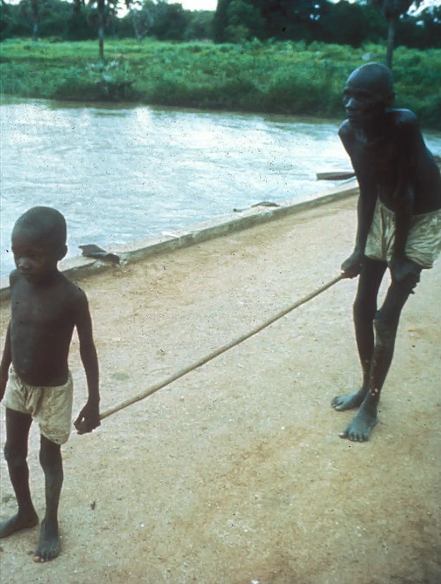 With Fewer Resources We re Finding Clever Ways To Map River Blindness With fewer resources we re finding clever ways to map river blindness