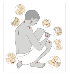 An illustration of a kneeling human being, with certain areas on the jaw, spine and neck marked to indicate degeneration