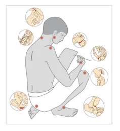 An illustration of a kneeling human being, with certain areas on the jaw, spine and neck marked to indicate degeneration